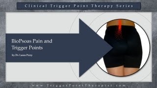 IlioPsoas Pain and Trigger Points [upl. by Stempien]