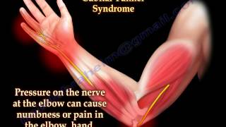 Cubital Tunnel Syndrome Ulnar Nerve Entrapment  Everything You Need To Know  Dr Nabil Ebraheim [upl. by Eckart]