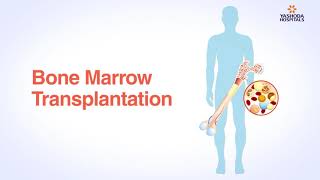 Bone Marrow Transplant  Patient Education  Yashoda Hospitals Secunderabad [upl. by Aivatan]