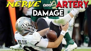 WORST College Football Injury Ever  Doctor Reviews McKenzie Milton Injury [upl. by Fagan]