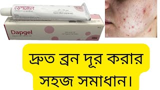 dapgel কি কাজ করেব্রন দূর করার ক্রিমacne gel uses bangla [upl. by Ester746]