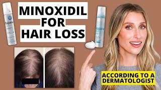 Dermatologist Explains How Minoxidil Works for Hair Loss How to Use Results amp More [upl. by Etyam]