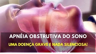 Apnéia Obstrutiva do Sono  uma doença silenciosa que pode matar [upl. by Jake]