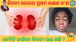 କେମିତି ଜାଣିବେ କିଡନୀ ଭଲ ଅଛି  First Symptom of Kidney Disease  Dr Chandan Patra KHUSI DIABETES CARE [upl. by Savick963]