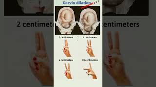 🤰🤰 Dilation of cervix 🤰🤰👩‍⚕️👩‍⚕️ [upl. by Aynad493]