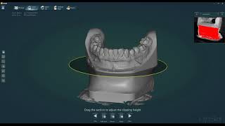 Scan Articulator In EXOCAD [upl. by Walters]