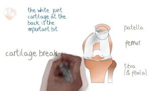 What Is The Patella [upl. by Ezirtaeb]