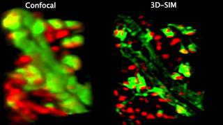 Confocal vs 3D structured illumination [upl. by Enitsirhc]