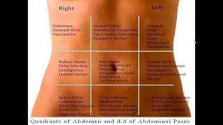 Differential diagnosis of abdominal pain according to abdominal regions [upl. by Mallen]