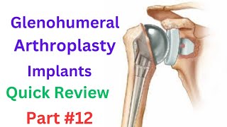 prosthetic Implants design  postoperative Complications  Glenohumeral Arthroplasty  Explained [upl. by Rede]