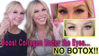 How to BOOST COLLAGEN UNDER the EYES NATURALLY  DOS and DONTS [upl. by Magel]