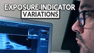 Exposure Indicator Variations [upl. by Leonora]