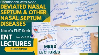 deviated nasal septum  disorders of nasal septum  nasal septum diseases  DrNajeebLecturesJr [upl. by Aw]