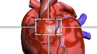 Circulação Coronariana [upl. by Irolav621]