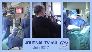 LOBECTOMIE PULMONAIRE PAR ROBOT ASSISTÉE ALZHEIMER ET SÉCURITÉ AUX BLOCS  CHU DIJON BOURGOGNE [upl. by Ellenahc]