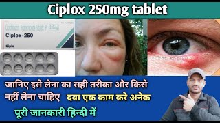 Ciplox 250 tablet use dose benefits and Side effects full review in hindi [upl. by Novla763]