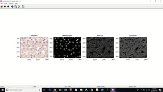 Chromogenic Assay CellProfiler Demo [upl. by Asenad579]