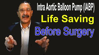 Intra Aortic Balloon Pump IABP Life Saving Before Surgery سرجری سے پہلے زندگی بچانے والا [upl. by Melitta690]