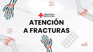 ¿Qué hacer en caso de una fractura PrimerosAuxilios [upl. by Noryd658]