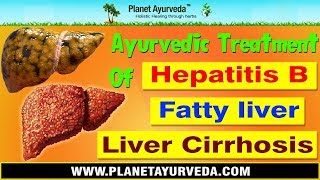 Ayurvedic Treatment of Hepatitis B Fatty liver amp Cirrhosis [upl. by Edecrem]