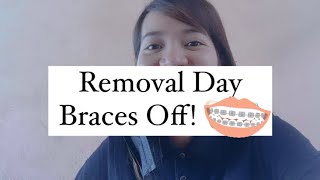 BRACES REMOVAL [upl. by Hammel]