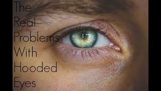 THE PROBLEM amp SOLUTIONS FOR VERY HOODED EYES [upl. by Melania]