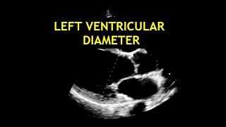 How to measure the LEFT VENTRICULAR DIAMETER Echocardiography [upl. by Frech]