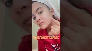 HOW TO USE LUXE ORGANIX HYDROCOLLOID ACNE PATCH🤍🫶angge budolniangge luxeorganix [upl. by Koral]