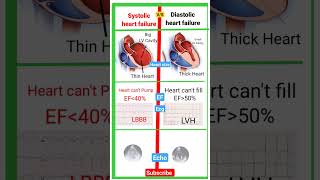 Difference between Systolic and Diastolic Heart Failure l ECG l Echo heartfailure shorts [upl. by Bunny]