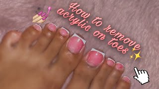 How to remove acrylic on toes without soaking BEGINNER FRIENDLY ✨ [upl. by Coreen]