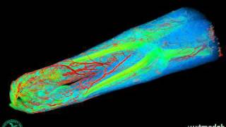 CTbased vascular anatomy of human arms [upl. by Sunda768]