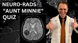 Neuroradiology quotAunt Minniequot Quiz [upl. by Ahsinut]