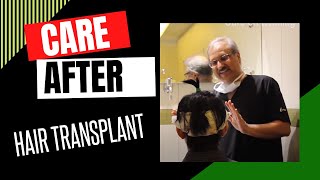 Care after hair transplant in India  Dr Bhatti Chandigarh [upl. by Donielle]