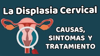 LA DISPLASIA CERVICAL Causas signos y síntomas diagnóstico y tratamiento [upl. by Ahsekahs]