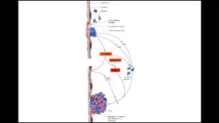 Fluid amp Haemodynamic derangements 2 [upl. by Dusa]