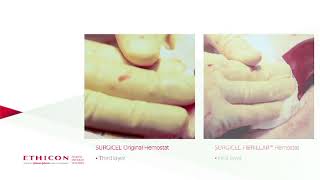 SURGICEL® FIBRILLAR™ vs SURGICEL® Original Hemostatic Efficacy Study [upl. by Etnovahs]