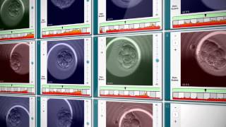 EmbryoScope® Timelapse System [upl. by Sibell124]