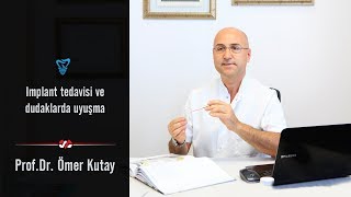 İmplant Tedavisi Ve Dudaklarda Uyuşma [upl. by Alleiram]