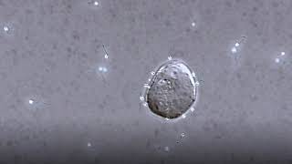 Sperm switch swimming patterns to locate egg [upl. by Ariuqahs361]