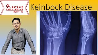 Keinbock Disease Orthopedic surgeons [upl. by Enait]