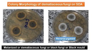 Melanized Fungal growth on SDA and list of black fungi [upl. by Alyakem422]