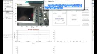 MATLAB  Citire date port serial si streaming video cu Raspberry Pi [upl. by Nessa787]