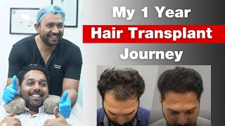 Best Cost of Hair Transplant in Mumbai Do your research hairtransplantcost [upl. by Zedekiah]