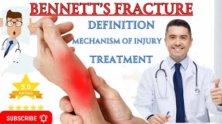 The Ultimate Guide to Bennetts Fracture Treatment Secrets [upl. by Leyla]