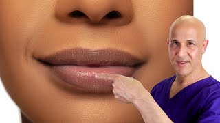 How to Plump Your Lips Naturally Dr Mandell [upl. by Spracklen118]