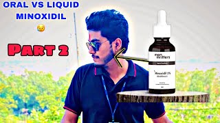 All products MinoxidilBeard gummies Derma roller Review  Oral vs Liquid minoxidil  Man matters [upl. by Lime93]