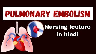 Pulmonary Embolism in hindi  cause pathophysiology symptoms management  nursing lecture [upl. by Bartosch]