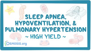 Apnea hypoventilation and pulmonary hypertension Pathology review [upl. by Oren]