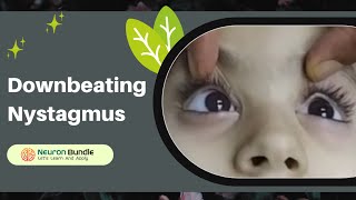 vertical eye movements  nystagmus  downbeat nystagmus nystagmus verticalnystagmus [upl. by Liarret944]