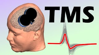 Transcranial magnetic stimulation TMS over the motor cortex [upl. by Ardek]